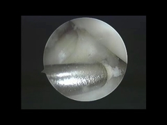 Zubereitungen für die Herstellung von