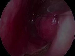 Einweg-Ultra-kleine und flexible Neurologie-Sonde PLA407