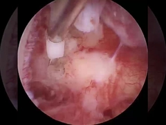 Zubereitungen für die Herstellung von